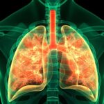 NMNはタバコ誘発性肺線維症による肺の損傷を緩和する