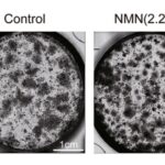 NMNは骨髄幹細胞を刺激し、より多い骨と少ない脂肪を形作る